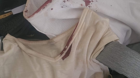"הוא התחיל להכות אותי בראש עם הנשק, ירד לי דם והוא המשיך" - חדשות  במעלה נט